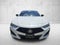 2025 Acura TLX w/A-Spec Package